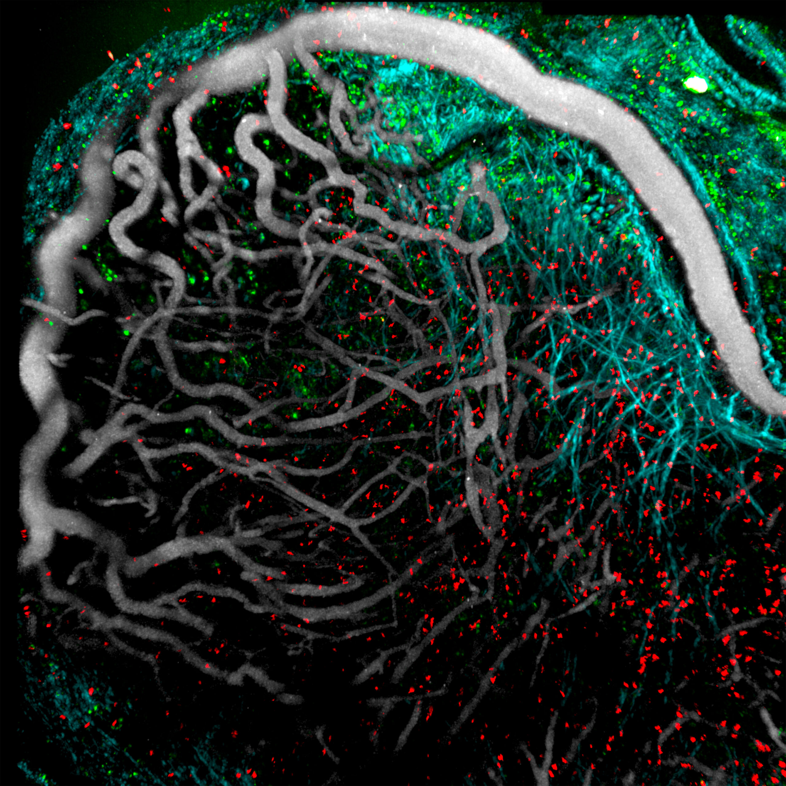This is an intravital 2-photon image of a mouse melanoma ten days post-engraftment, with CD8+ tumor-infiltrating lymphocytes (TILs, orange and red), dendritic cells (green), blood vessels (Qdot, gray), and collagen fibers (second harmonic generation, cyan).
