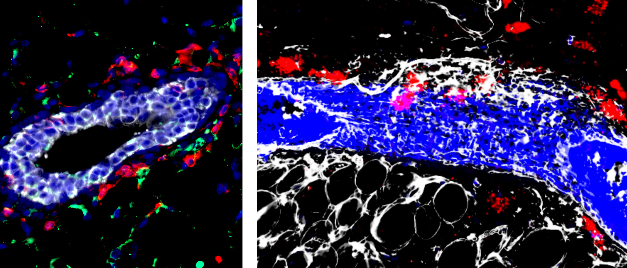 LEFT: Mammary gland macrophages (red) expressing the receptor CXCR4 (green) that localize to the mammary epithelium (white), where they support branching morphogenesis and promote mammary tumorigenesis. RIGHT: Macrophages (red) infiltrating through the collagen-rich basement membrane (white) to contact the mammary epithelium (blue).