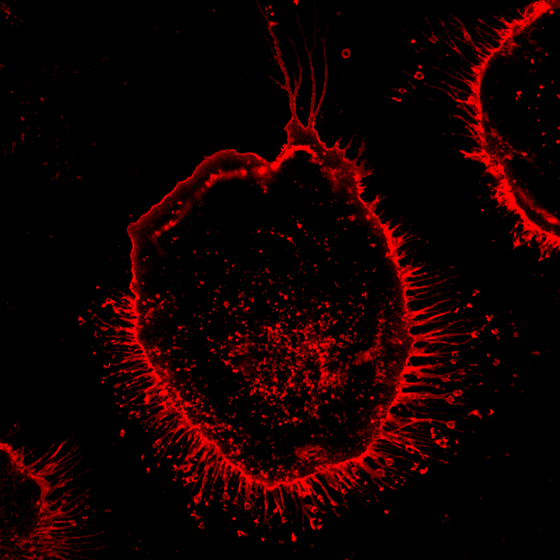 Macrophage activated by exposure to lipopolysaccharide, stained with the lectin phytohemagglutinin-L (PHA-L), which labels asialoglycans red on the macrophage surface. Macrophages can transfer their own calreticulin (CALR) proteins to exposed asialoglycans on sick, unwanted or dying cells to direct their removal by phagocytosis, a process known as programmed cell removal.