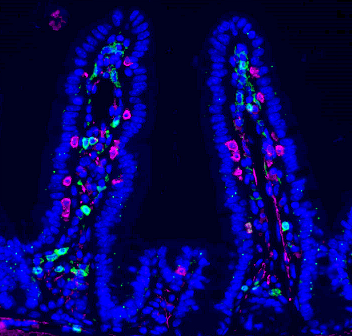 Immunostaining of mouse small intestine for DNA (blue), CD4+ (red), and CD8+ (green) T cells.