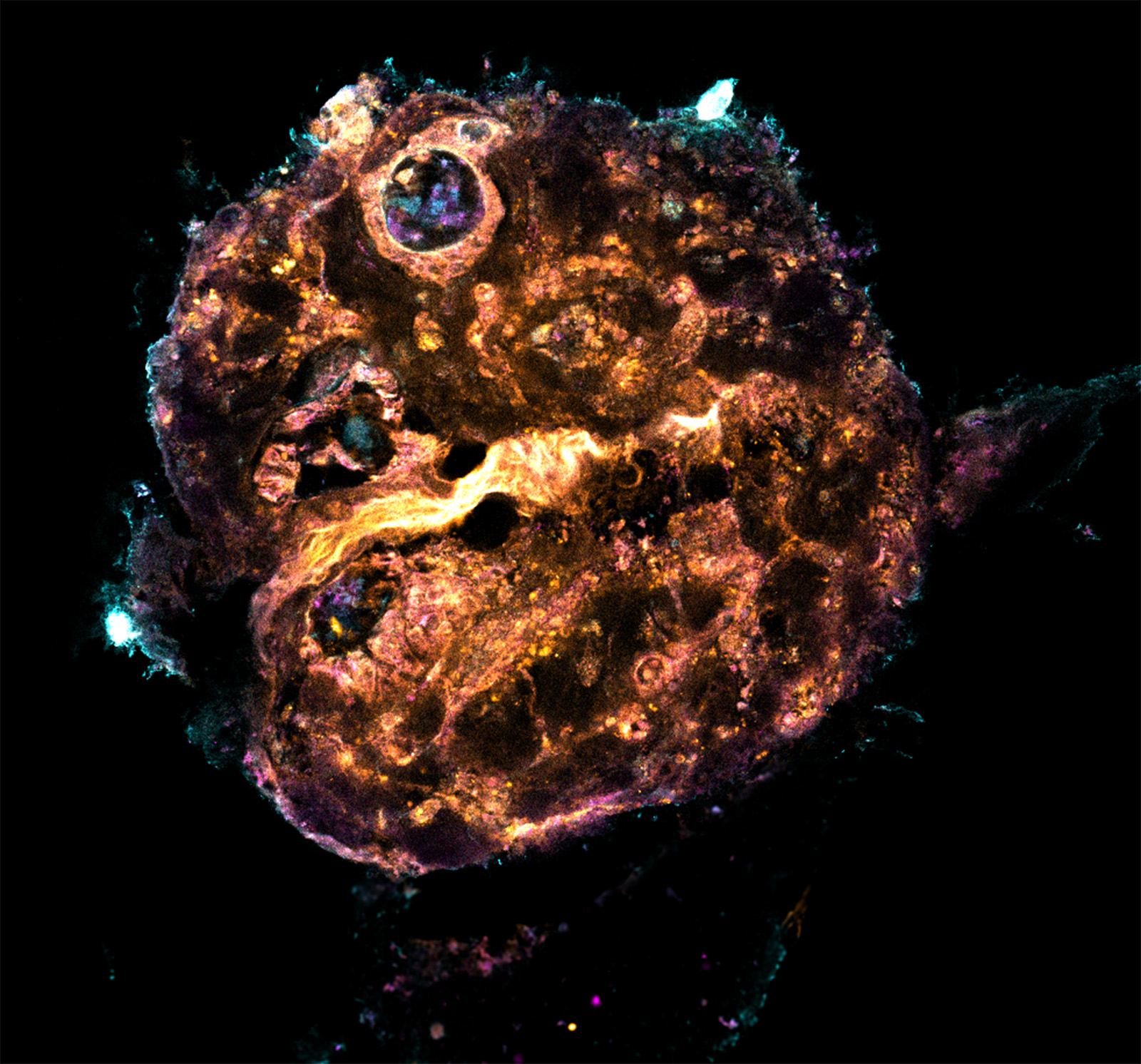 This image captures a combined human bone and lympho-myeloid bone marrow organoid cultured in a rotationally and gravitationally driven, pump-free bio-compatible microfluidic device.