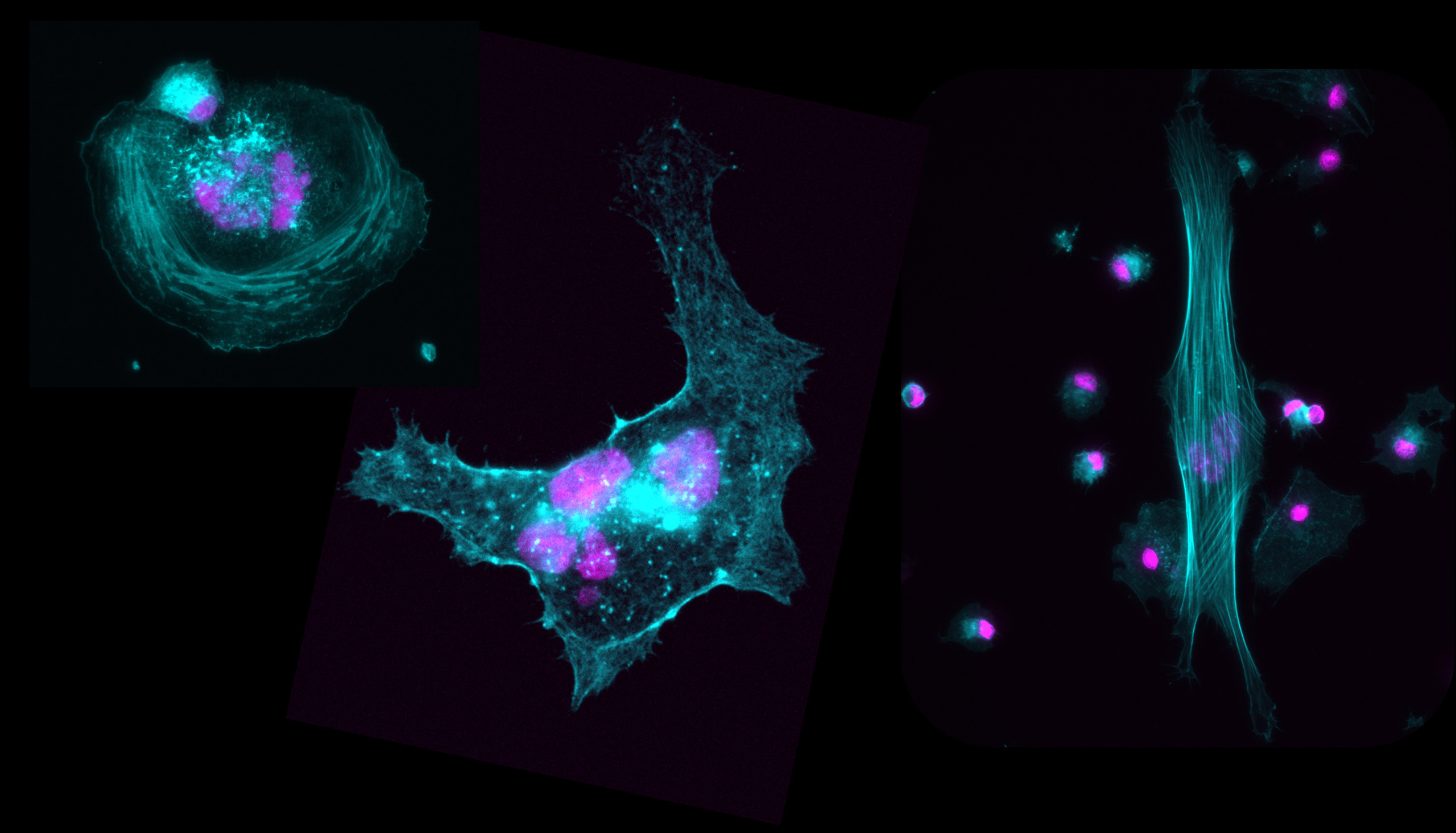 This image comes from our investigations into how changes in the bone marrow microenvironment affect megakaryocytes (Mks), the precursors of platelets.