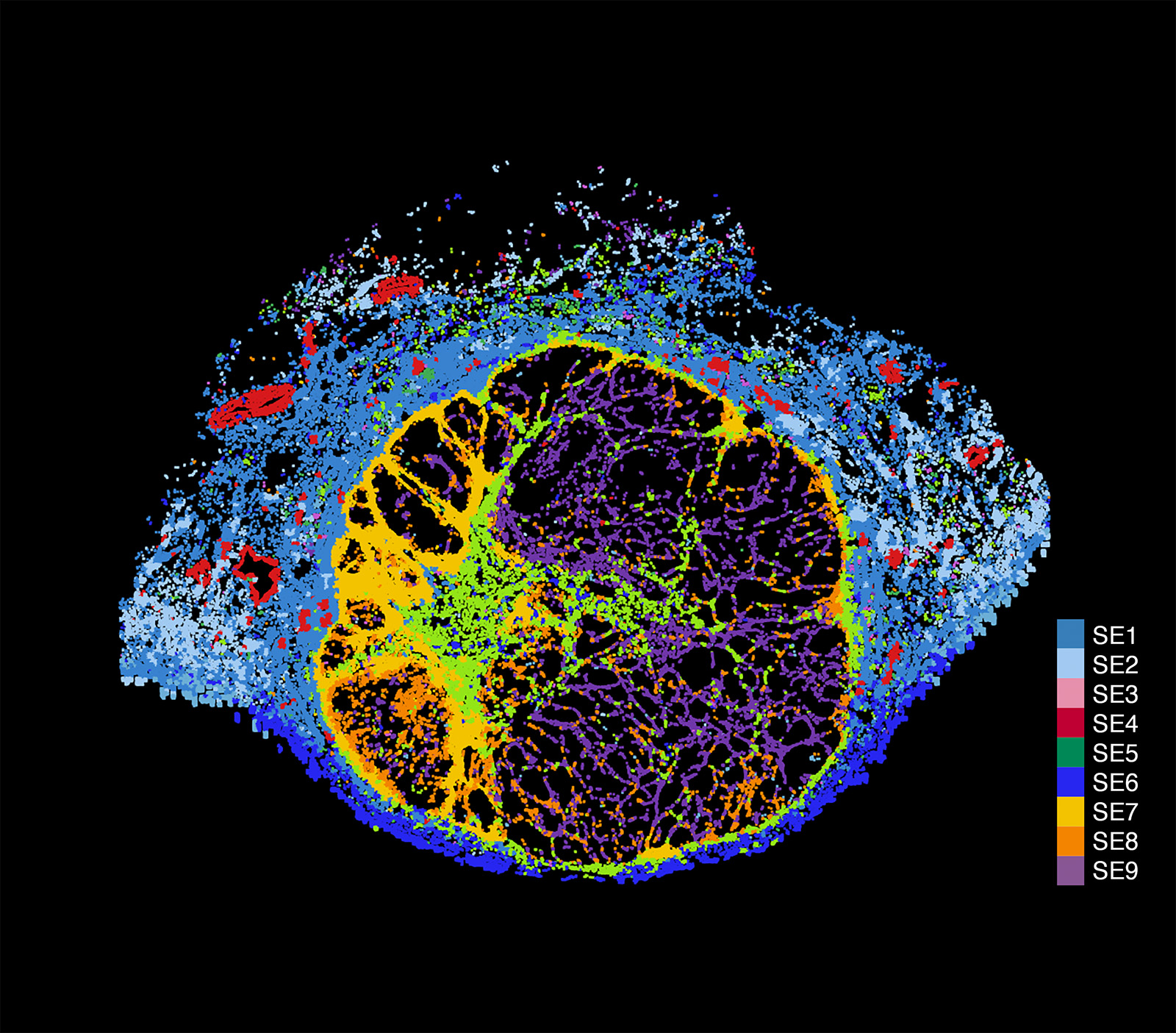 Nine multicellular environments, called spatial ecotypes, are shown here for a melanoma tumor sample. Spatial ecotypes are associated with patient survival and treatment.