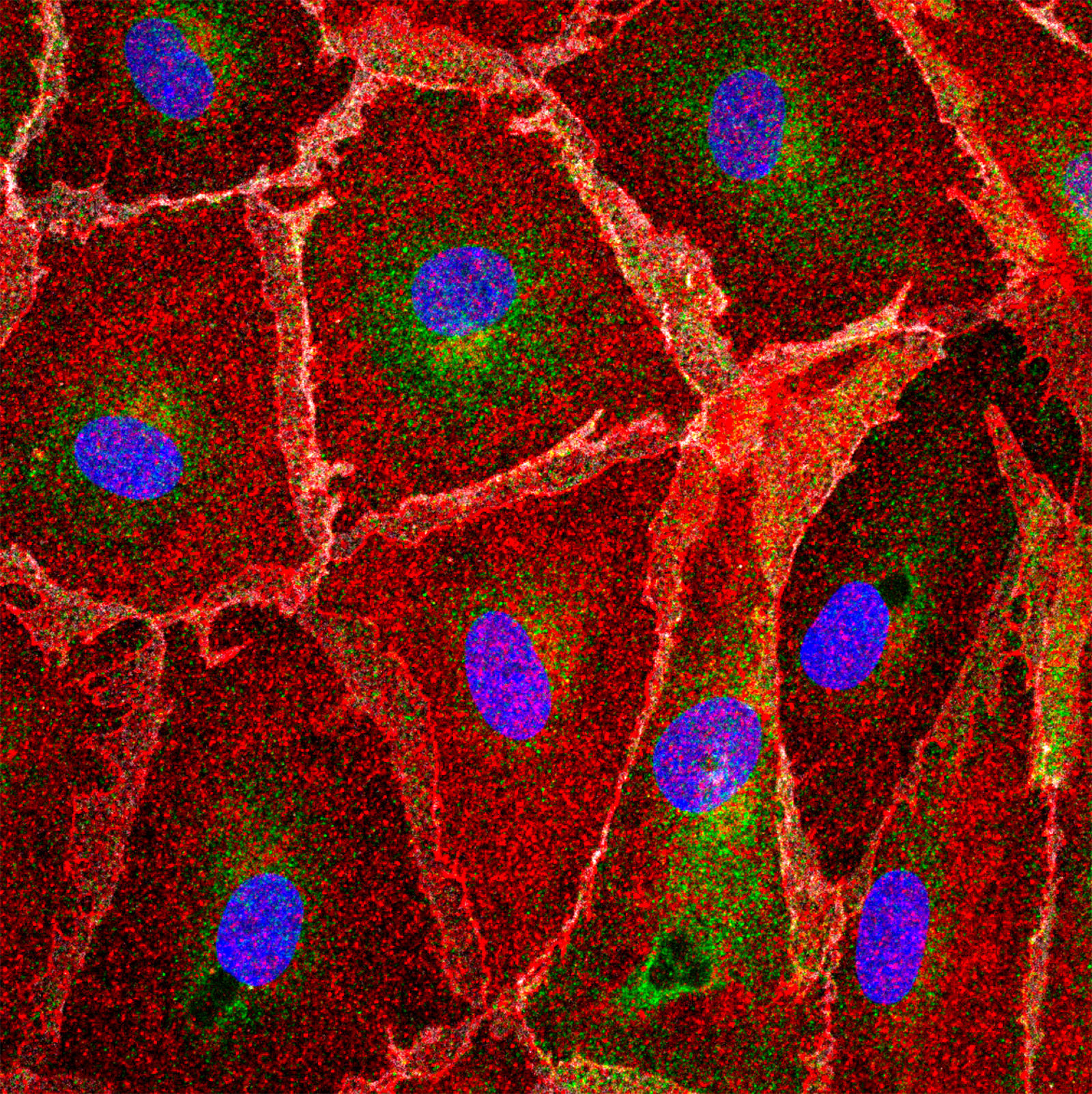Endothelial cells stained for MYCT1 (red), VE-cadherin (white) and IFITM2/3 (green).