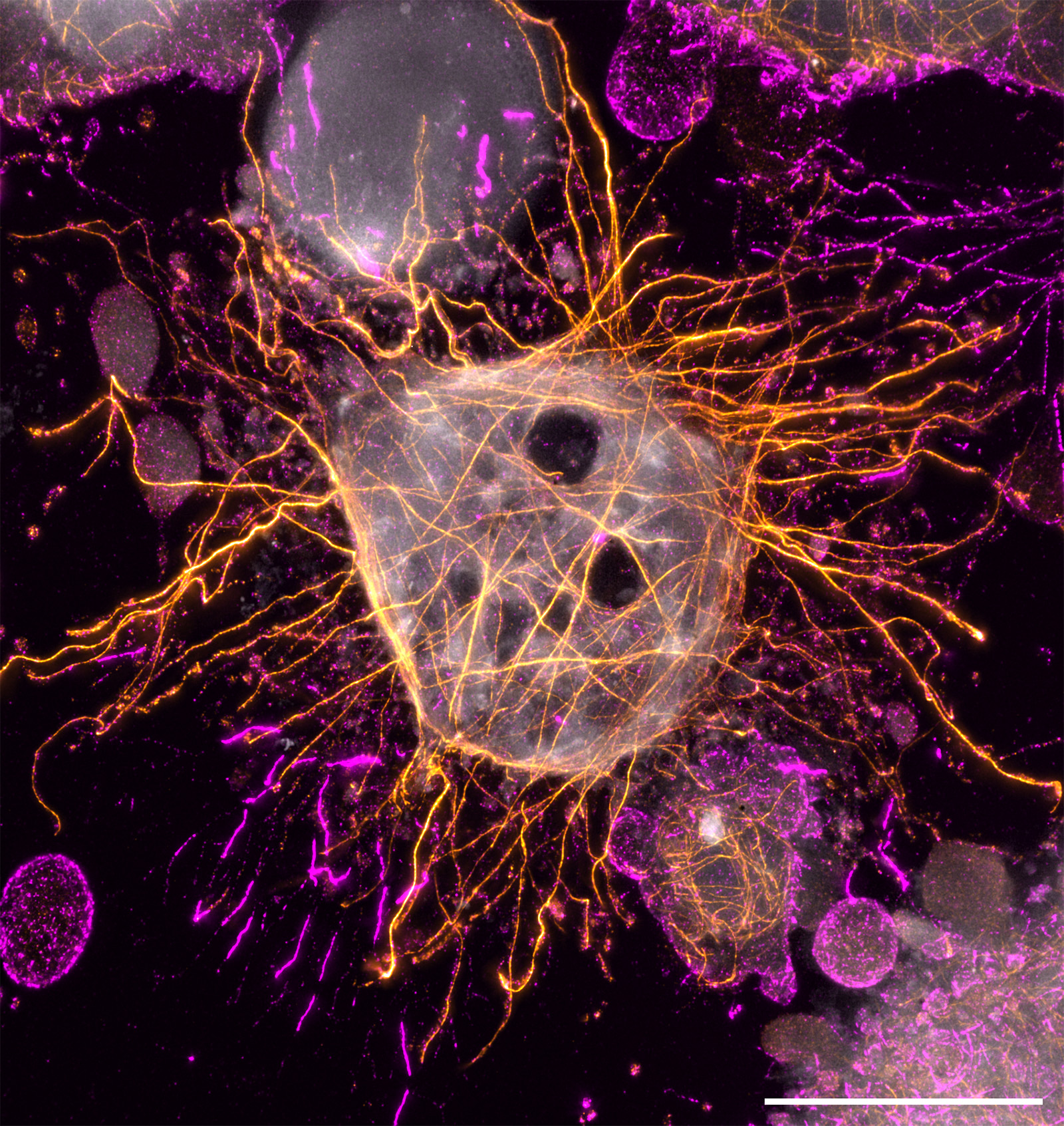 Displayed here is a dying human melanoma cell (GEFI) after co-culture with cytotoxic CD4+ T cells, labeled for actin (magenta) and tubulin (orange), with an NHS-ester counterstain of primary amines (gray). Scale bar: 10 μm (corrected for the expansion factor).